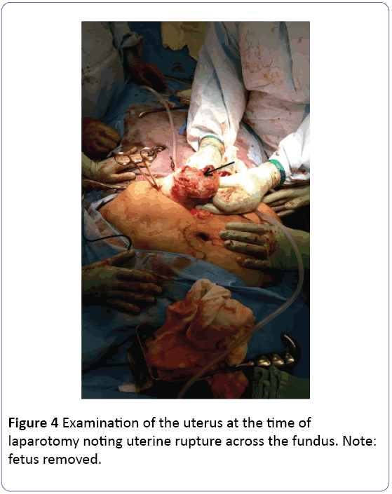 Obstetrics-Gynecology-Examination-uterus-laparotomy