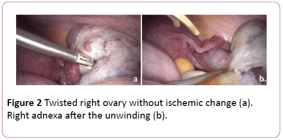 Obstetrics-Gynecology-Right-adnexa