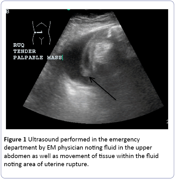 Obstetrics-Gynecology-Ultrasound-emergency-physician