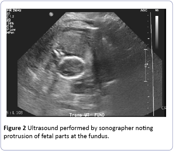 Obstetrics-Gynecology-Ultrasound-sonographer-protrusion