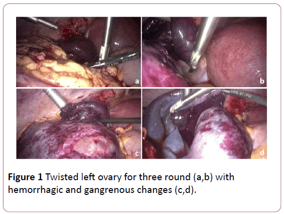 Obstetrics-Gynecology-hemorrhagic-gangrenous