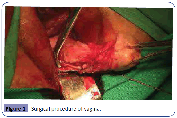 Obstetrics-Surgical-procedure