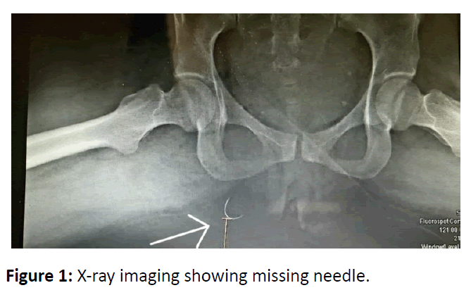 critical-care-obstetrics-missing-needle