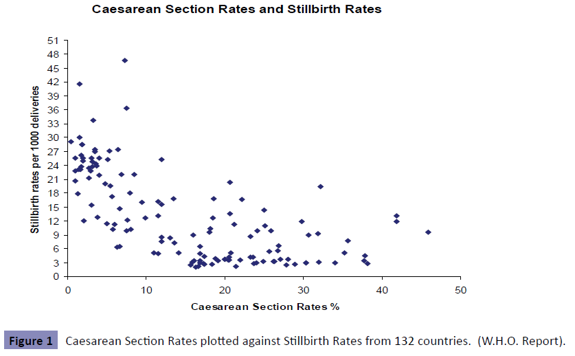 obstetrics-Caesarean-Section